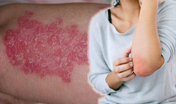 Bőrbetegségek enyhítése gyógygombákkal
